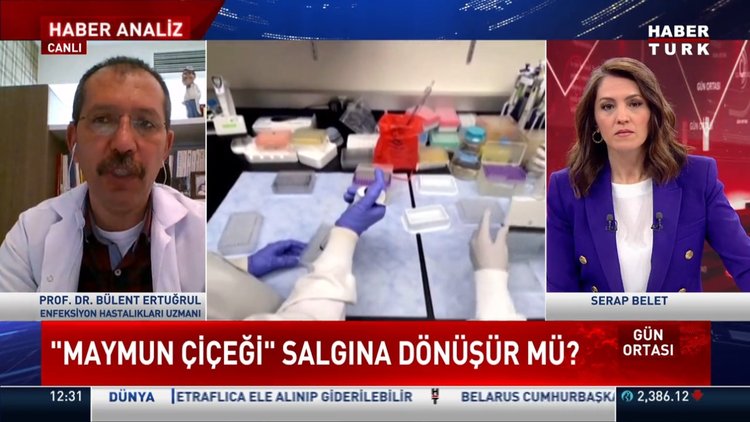 Maymun çiçeği virüsü nedir? Maymun çiçeği salgına dönüşür mü? Maymun çiçeği virüsü belirtileri neler?
