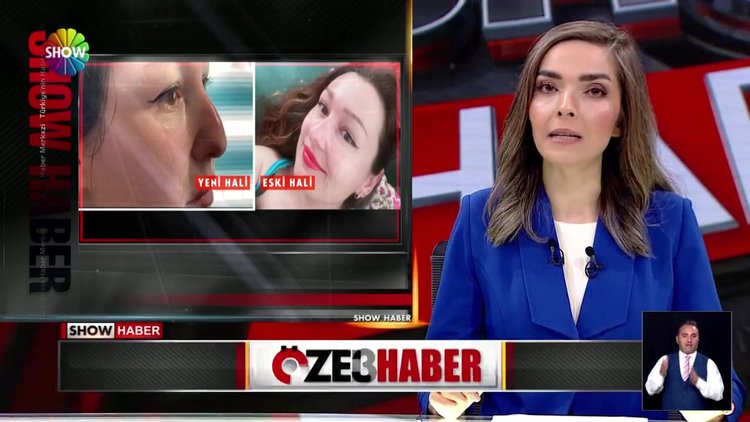 Burun dolgusu rezaleti