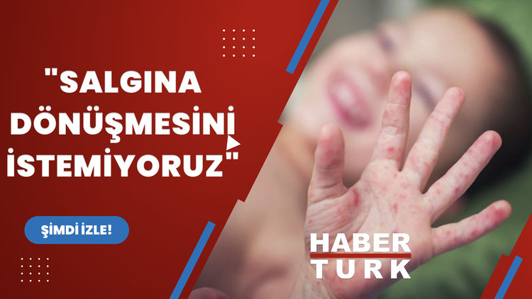 "Salgına dönüşmesini istemiyoruz"