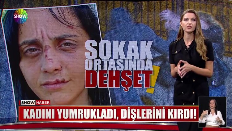 Kadını yumrukladı, dişlerini kırdı!