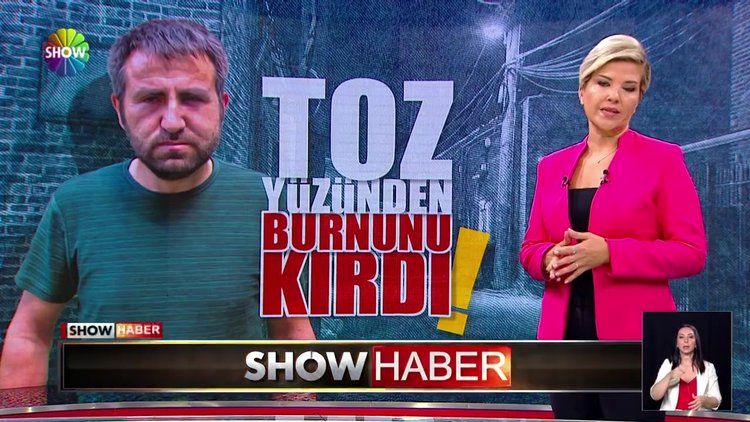 Toz yüzünden burnunu kırdı!
