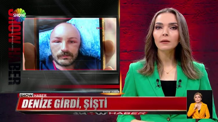 Denize girdi, bu hale geldi