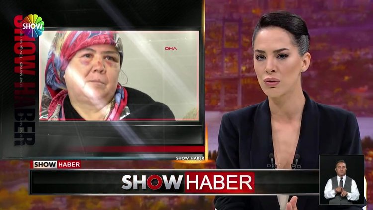 Çarptı arkasına bile bakmadan kaçtı!