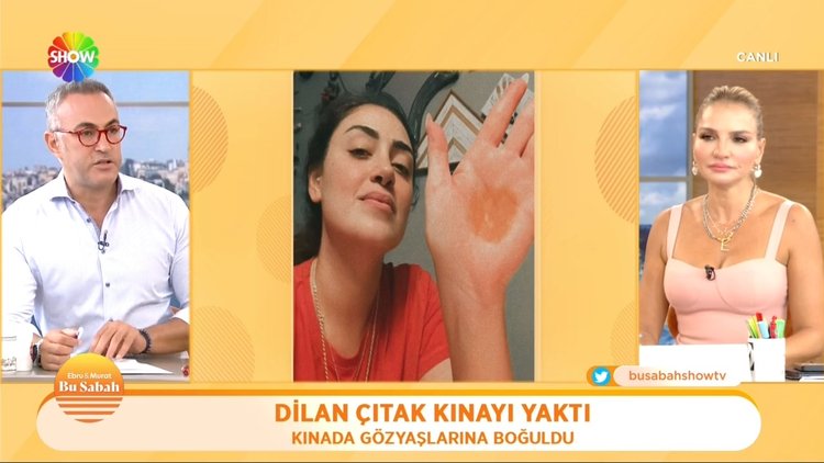 Dilan Çıtlak kınayı yaktı!