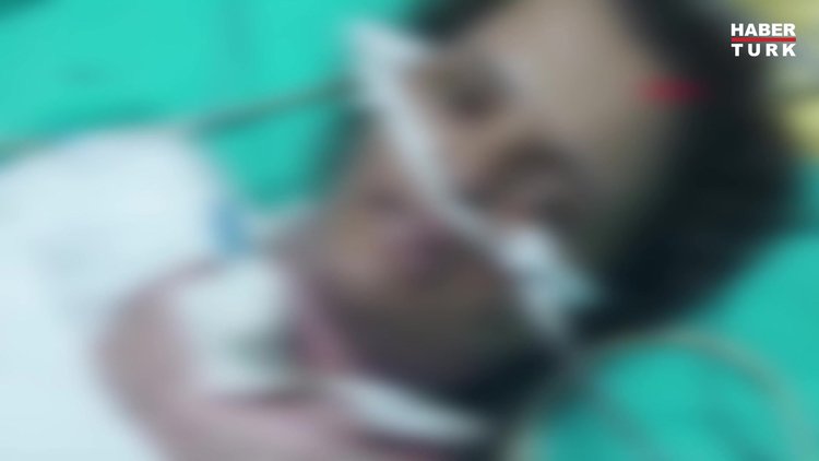 Dezenfektanın parlamasıyla yanan Havva, 75 gündür yoğun bakımda