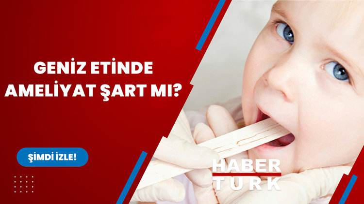 Geniz etinde ameliyat şart mı?