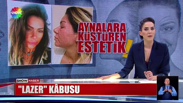 Güzelleşmek isterken kâbusu yaşadı