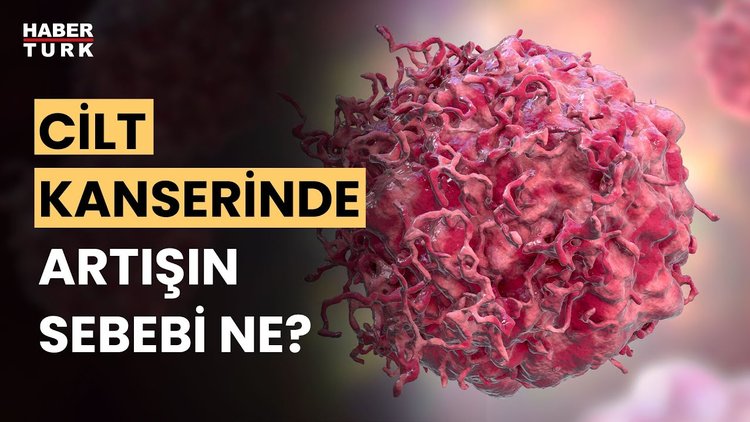 Cilt kanserinden nasıl korunmalıyız? Prof. Dr. Ömer Özkan anlattı