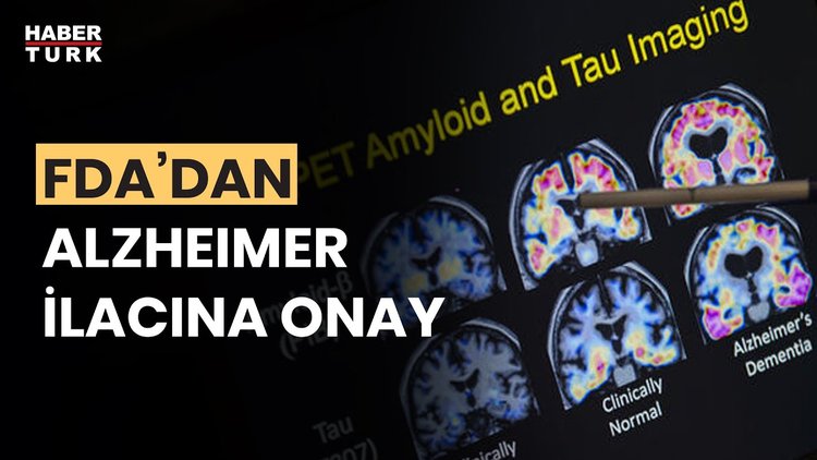 FDA, Alzheimer'ın ilerlemesini yavaşlattığı gözlenen ilaca tam onay verdi