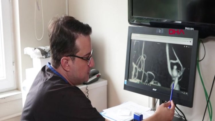  Ölümcül beyin anevrizmasıyla ilgili yeni keşif