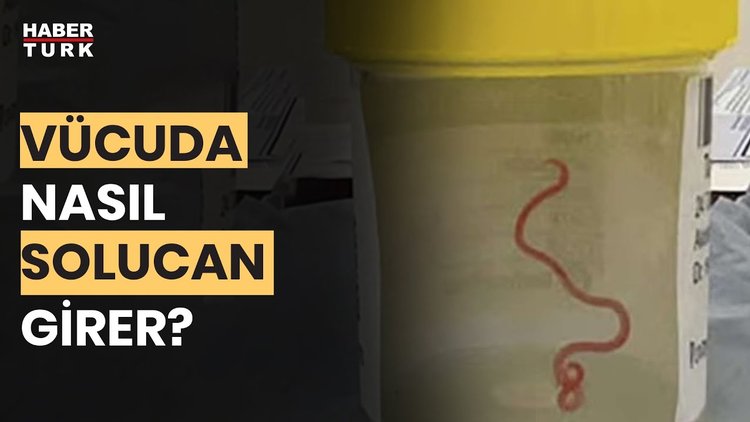 İnsan beyninde solucan nasıl olur? Prof. Dr. Başar Bilgiç yanıtladı