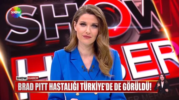 Brad Pitt hastalığı Türkiye'de de görüldü!