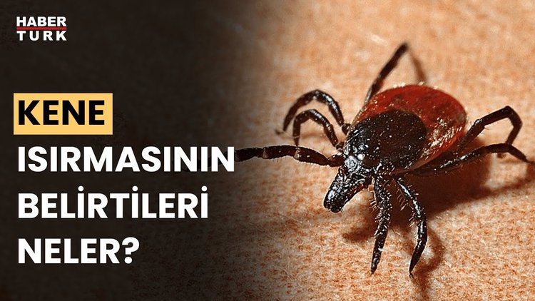 Vücutta kene fark edince ne yapmalı?