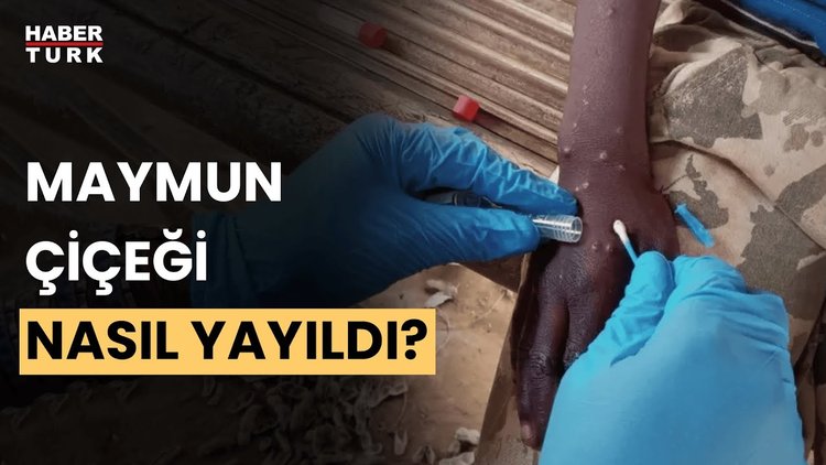 Virüs Afrika&#039;da hangi ülkelerde çıktı, nerelere yayıldı? Afrika Araştırmacısı Fırat Karaboğa anlattı