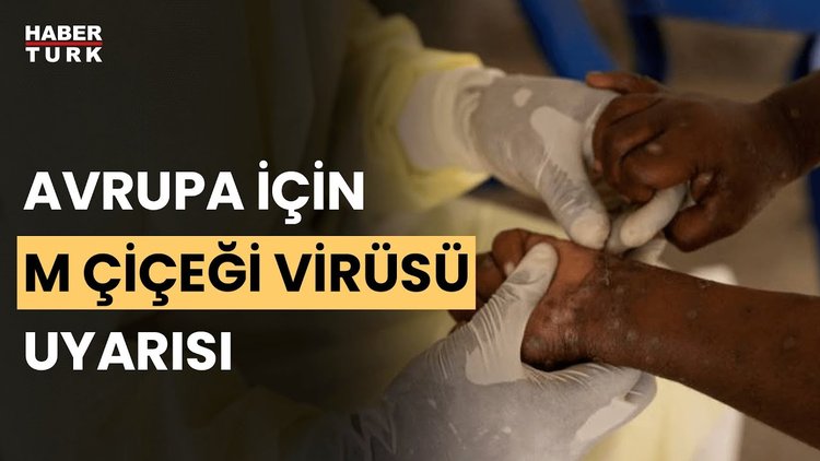 Avrupa&#039;da maymun çiçeği virüsü uyarısı: Risk düşük ancak hazırlıklı olunmalı