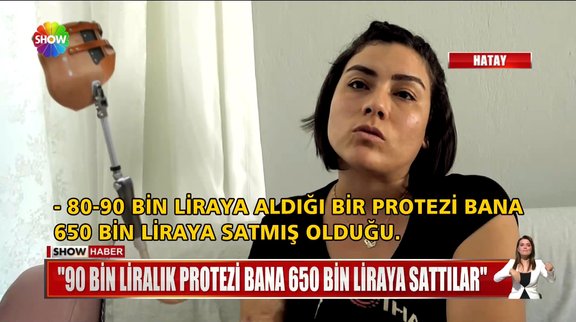 Protez bacak vicdansızlığı!