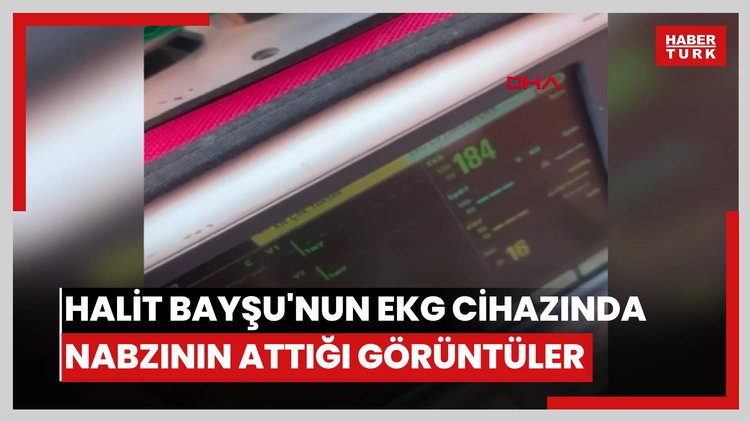 Halit Bayşu'nun EKG cihazında nabzının attığı görüntüler ortaya çıktı