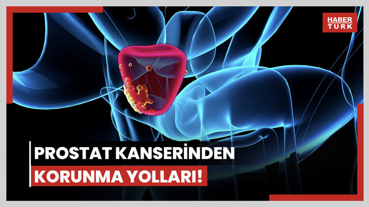 Prostat kanserinden korunma yolları! Nüfus yaşlandıkça risk artıyor