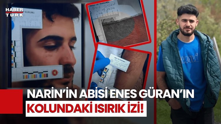 Narin'in Ağabeyi Enes Güran'ın Kolundaki İzlerin Görüntüleri Ortaya Çıktı!