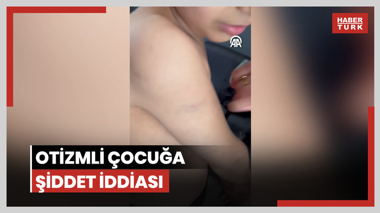 Otizmli çocuğa şiddet iddiası!