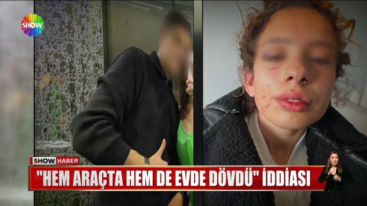 Sevgilisine işkence yaptı!