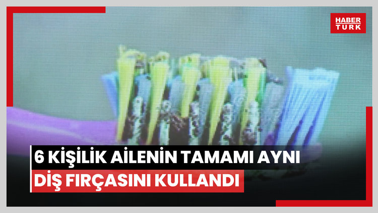 Bilimsel sunumda ortaya çıktı: 6 kişilik ailenin tamamı aynı diş fırçasını kullandı