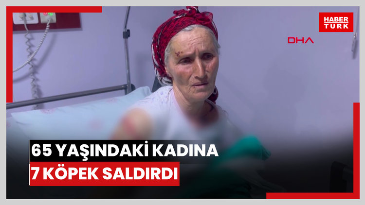 65 yaşındaki kadına 7 köpek saldırdı; vücuduna 50 dikiş atıldı
