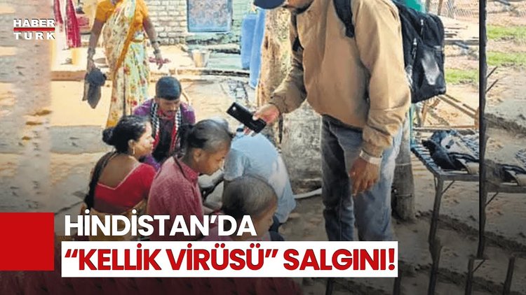 Hindistan'da Gizemli "Kellik Virüsü" Paniğe Neden Oldu