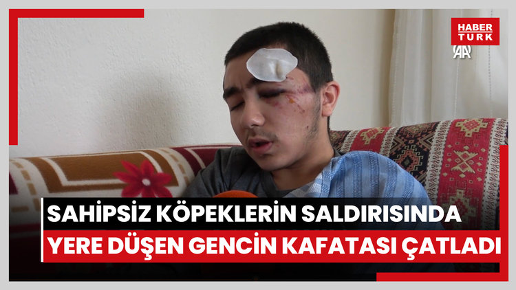 Sahipsiz köpeklerin saldırısında yere düşen gencin kafatası çatladı