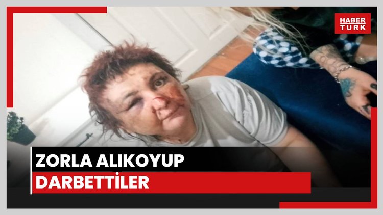 Zorla alıkoyup darbettiler