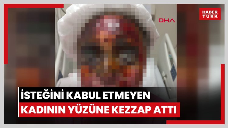 Avcılar'da görüşme isteğini kabul etmeyen kadının yüzüne kezzap attı
