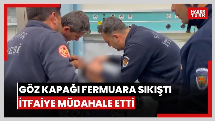 Göz kapağı fermuara sıkıştı