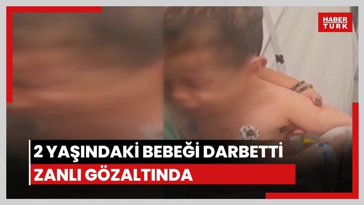 2 yaşındaki bebeği darbetti