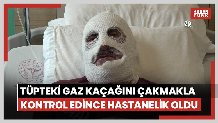 Tüpteki gaz kaçağını çakmakla kontrol edince hastanelik oldu