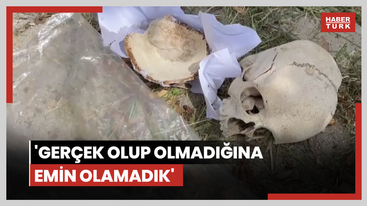Çöpten kağıda sarılı insan kafatası çıktı