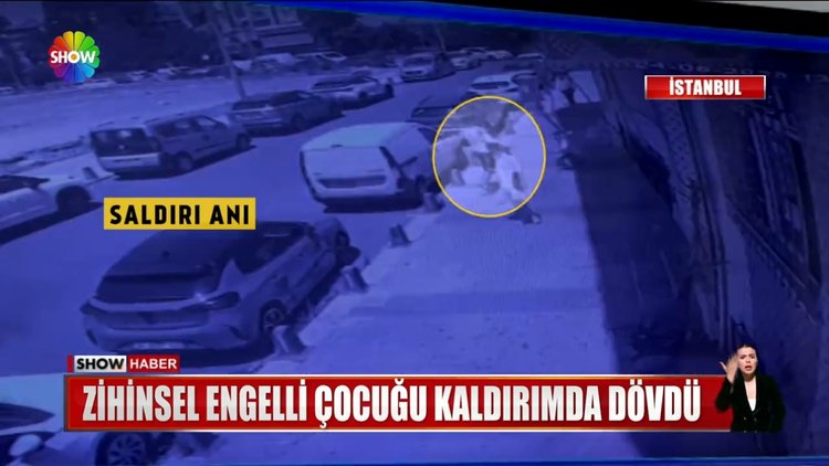 Engelli çocuğa dayak attı!