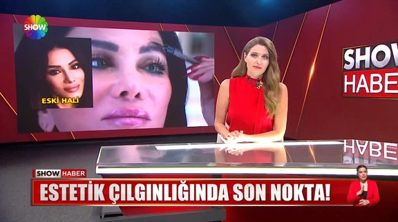Ameli̇yatla göz rengi̇ni̇ deği̇şti̇rdi̇!