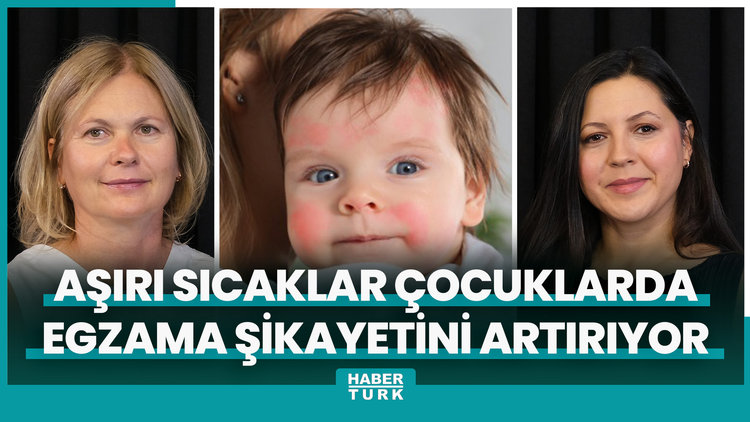Aşırı sıcaklar çocuklarda egzama şikayetini artırıyor
