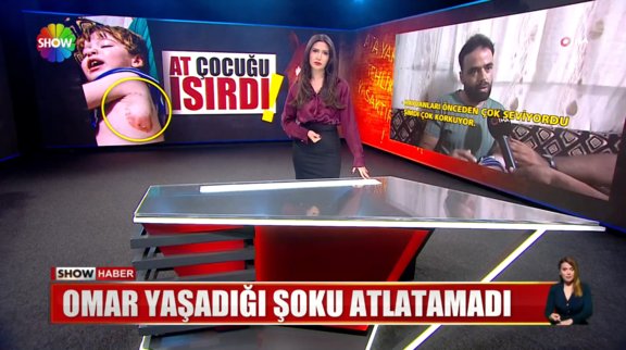 At, çocuğu ısırdı!