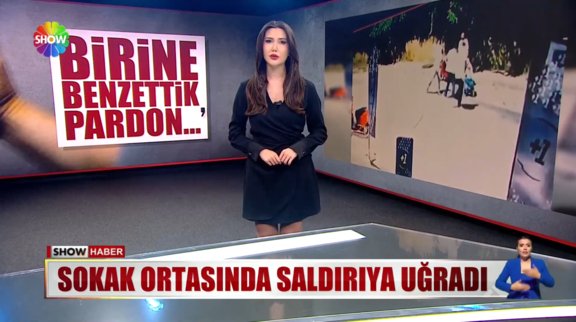 Sokak ortasında dayak yedi! 