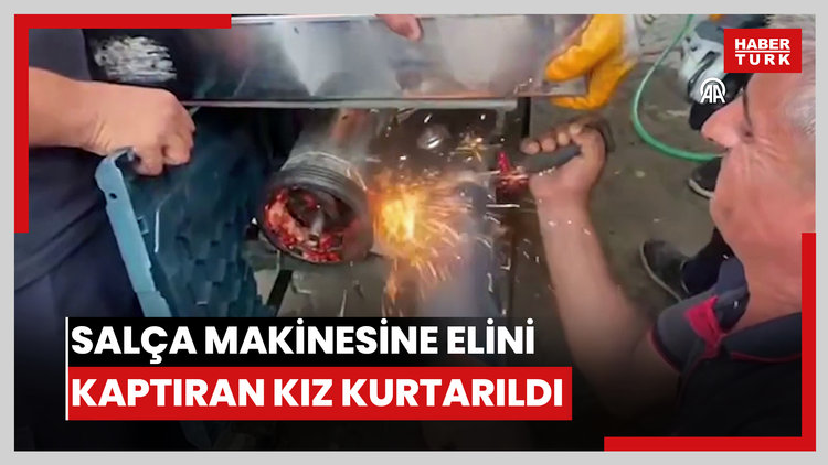 Salça makinesine elini kaptıran genç kız ameliyatla kurtarıldı