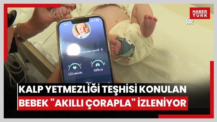 Anne karnında kalp yetmezliği teşhisi konulan bebek "akıllı çorapla" izleniyor