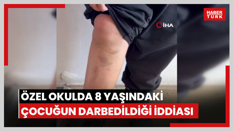 Diyarbakır'da özel okulda 8 yaşındaki çocuğun darbedildiği iddiası