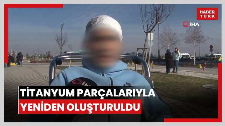 Akran zorbalığına maruz kalan 13 yaşındaki çocuğun kafatası titanyum parçalarıyla yeniden oluşturuldu
