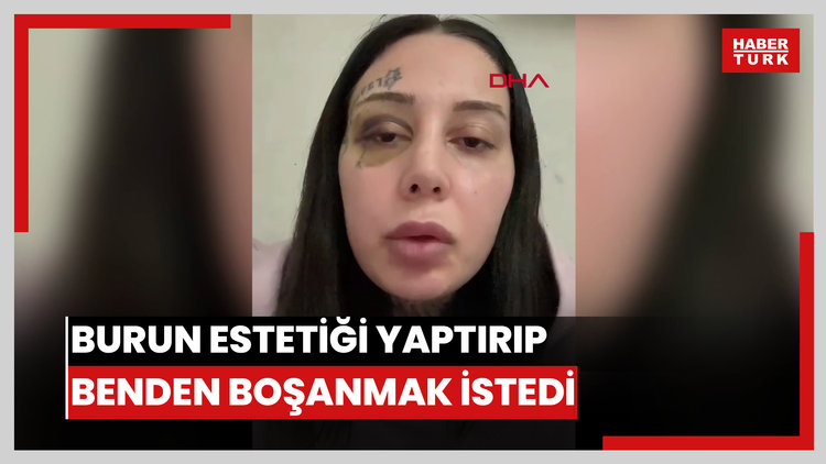 Kağıthane'de eşini silah çekip darbeden Bilal: Burun estetiği yaptırıp benden boşanmak istedi