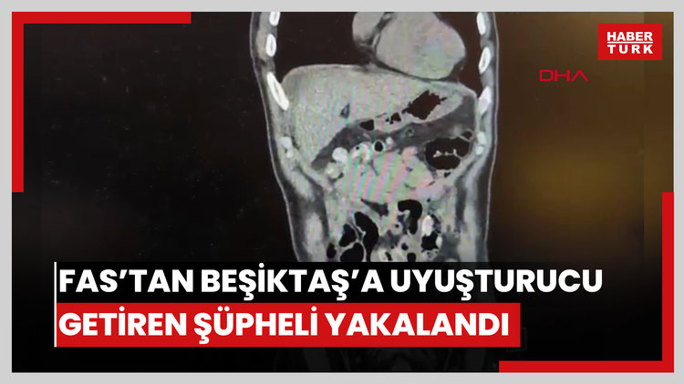 Fas'tan Beşiktaş'a midesinde uyuşturucu getirdi; ameliyatla çıkarıldı