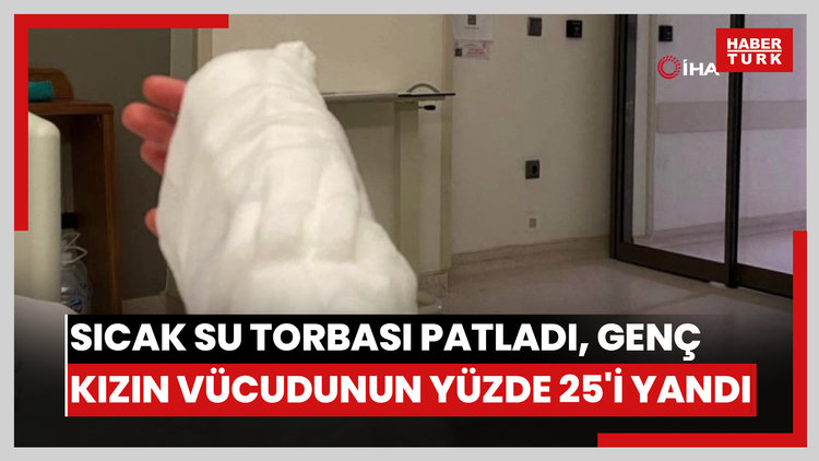 Sıcak su torbası patladı, genç kızın vücudunun yüzde 25'i yandı