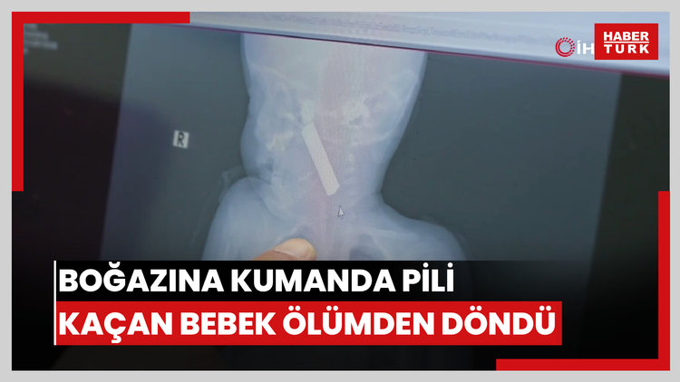 Boğazına kumanda pili kaçan bebek ölümden döndü