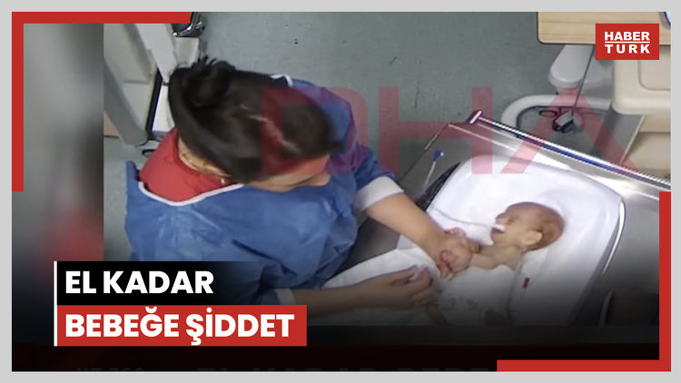 5 günlükken darp edildi, engelli kaldı!