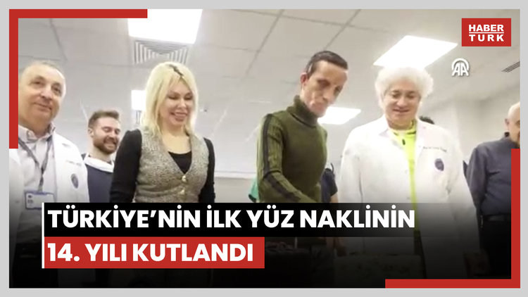 Türkiye'nin ilk yüz naklinin 14. yılı kutlandı